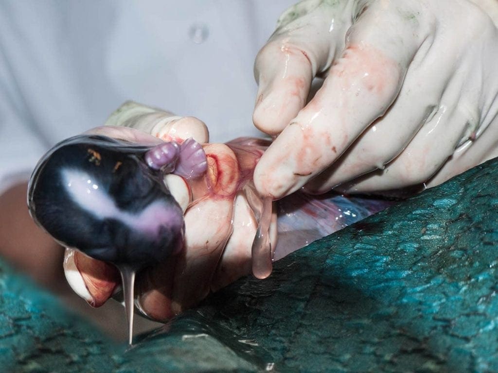 caesarean birth