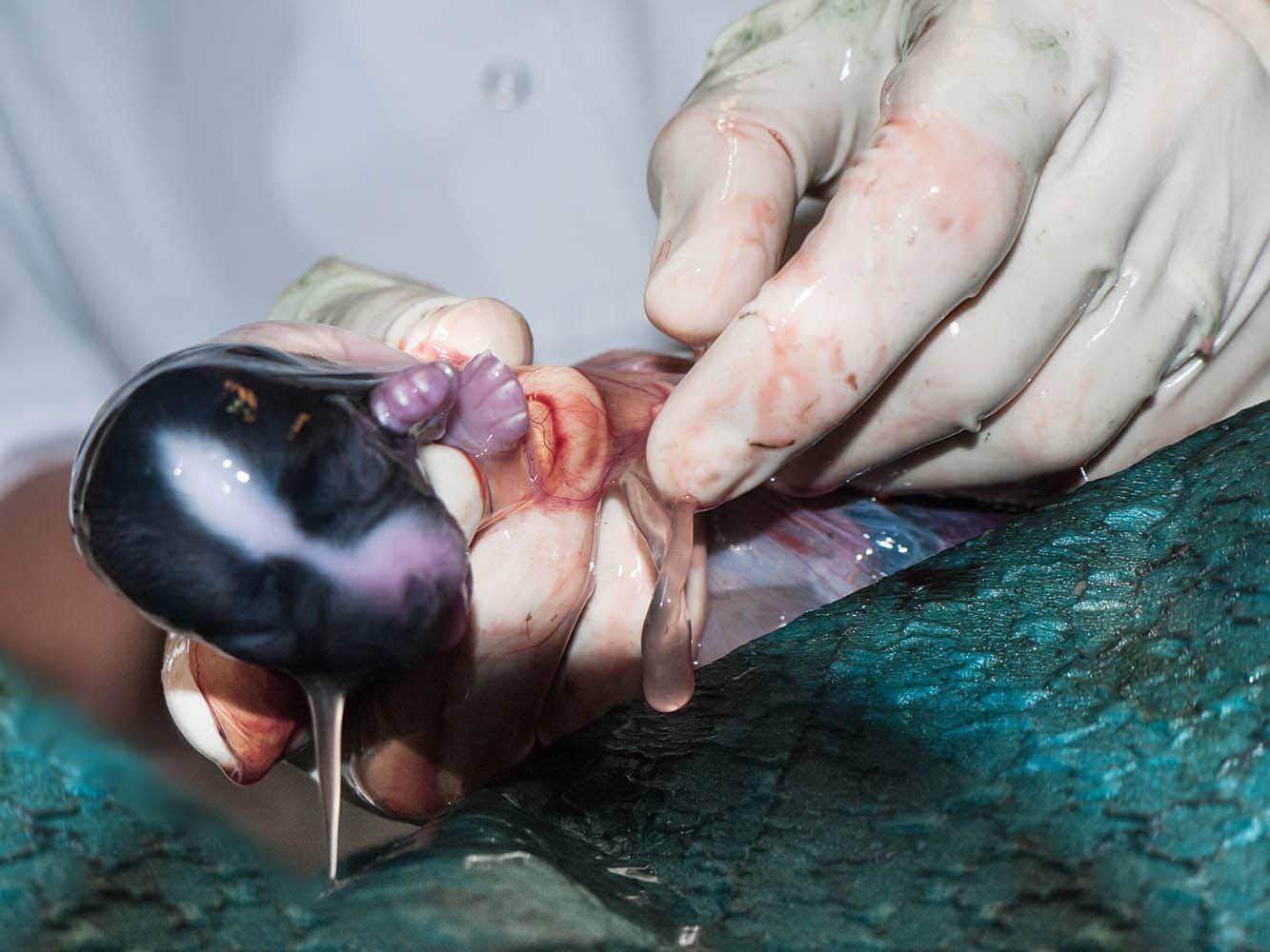 caesarean birth