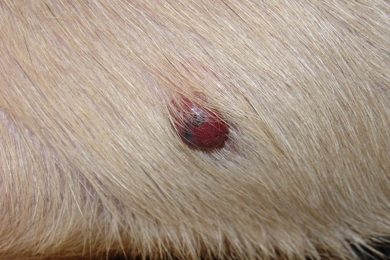 Hemangiosarcoma of skin