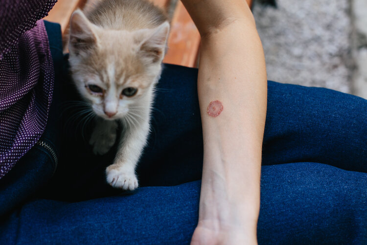 ringworm zoonoses