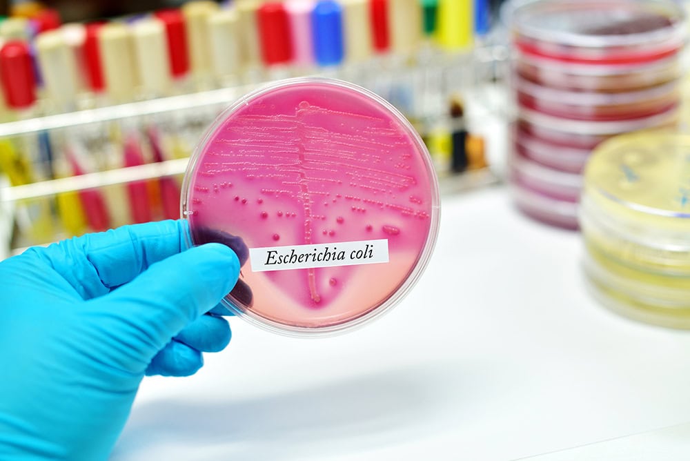 bacteria colony of e coli in culture media plate