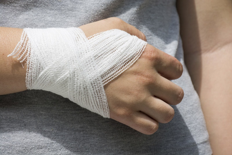 bandaged hand held against the body
