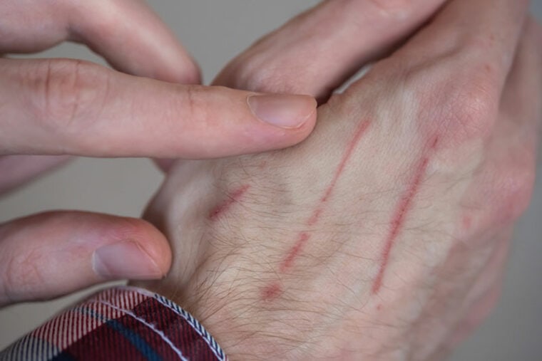 how-to-treat-a-cat-scratch-8-vet-approved-tips-hepper-pet-resources